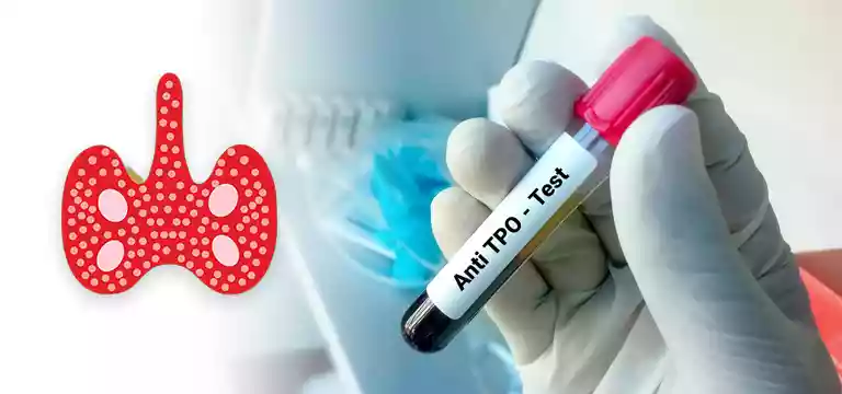 Unfolding the Utility of Anti TPO (Thyroid Peroxidase) Antibody Test
